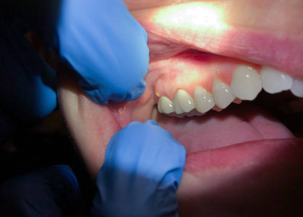 Best Pediatric Emergency Dentist in Beaver Dam, WI